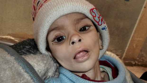 HAMBRE EN EL CAMPO DE REFUGIADOS DE YARMOUK