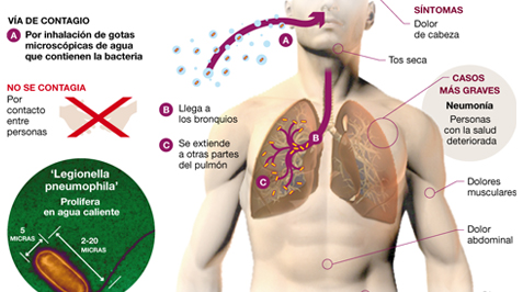 CONTINÚA EL BROTE DE LEGIONELLA CON UNA VÍCTIMA MÁS