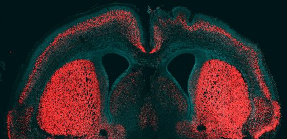 ARHGAP11B, UN GEN HORRÍSONO PERO DE GRAN INTELIGENCIA