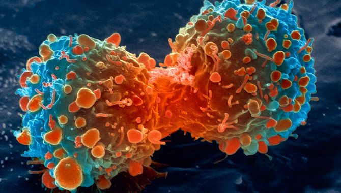 20150309 cancer670
