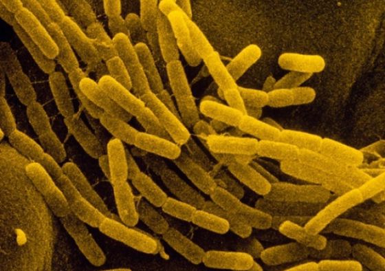 20150312 bacteria