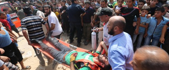 20150807 gaza