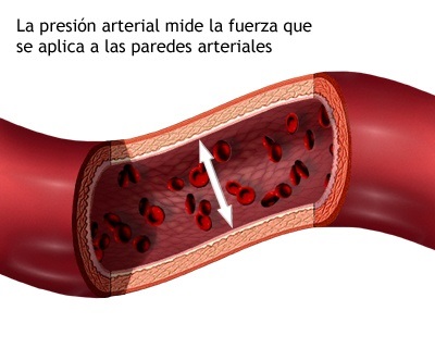 20160107 tensión