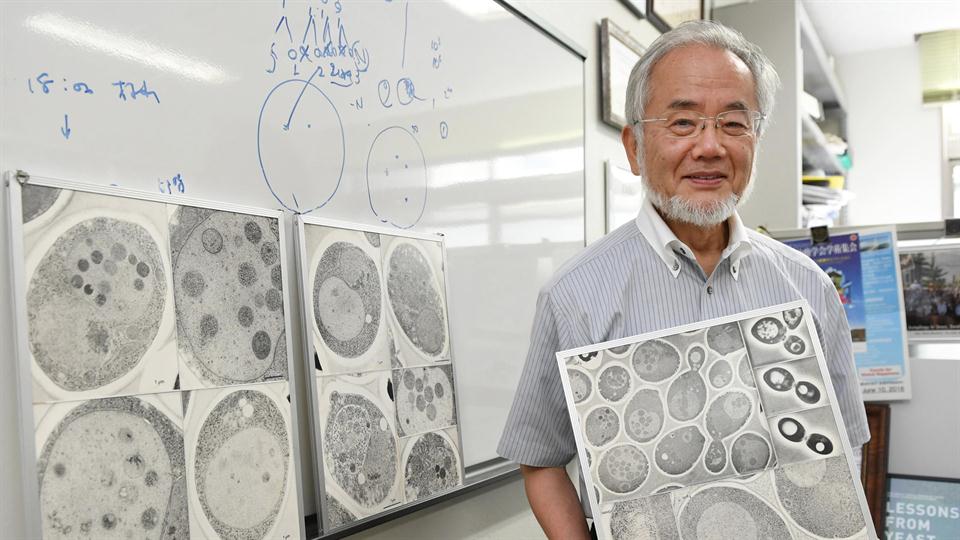 NOBEL DE MEDICINA 2016 A UN APASIONADO DE LOS MICROSCOPIOS Y LAS LEVADURAS