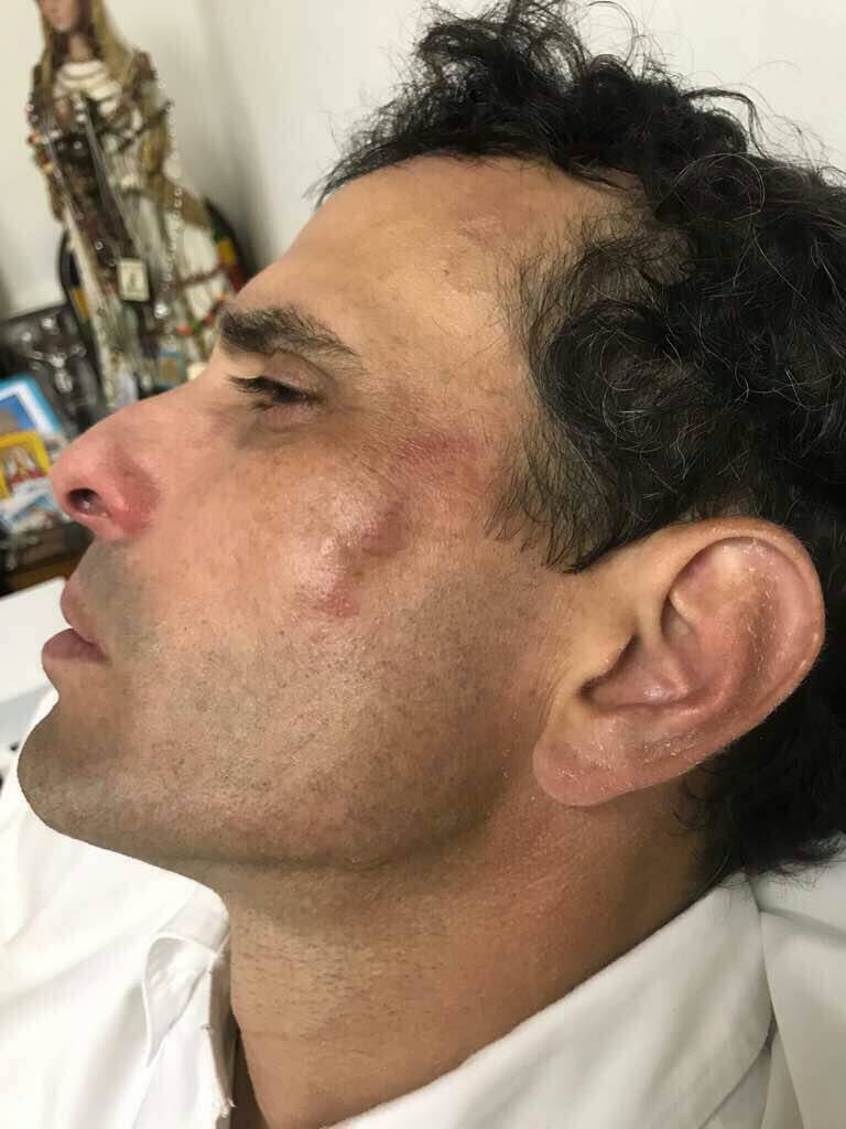 20170530 capriles