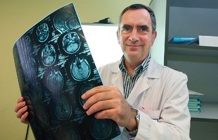 EL SERVICIO DE NEUROLOGIA DE BASURTO EN REFERENCIA POR ESTUDIOS SOBRE ACCIDENTE CEREBROVASCULAR