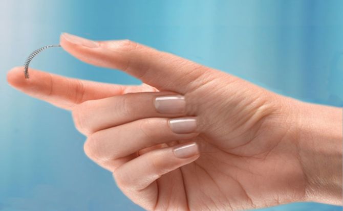 SE RETIRA EL ANTICONCEPTIVO 'ESSURE'