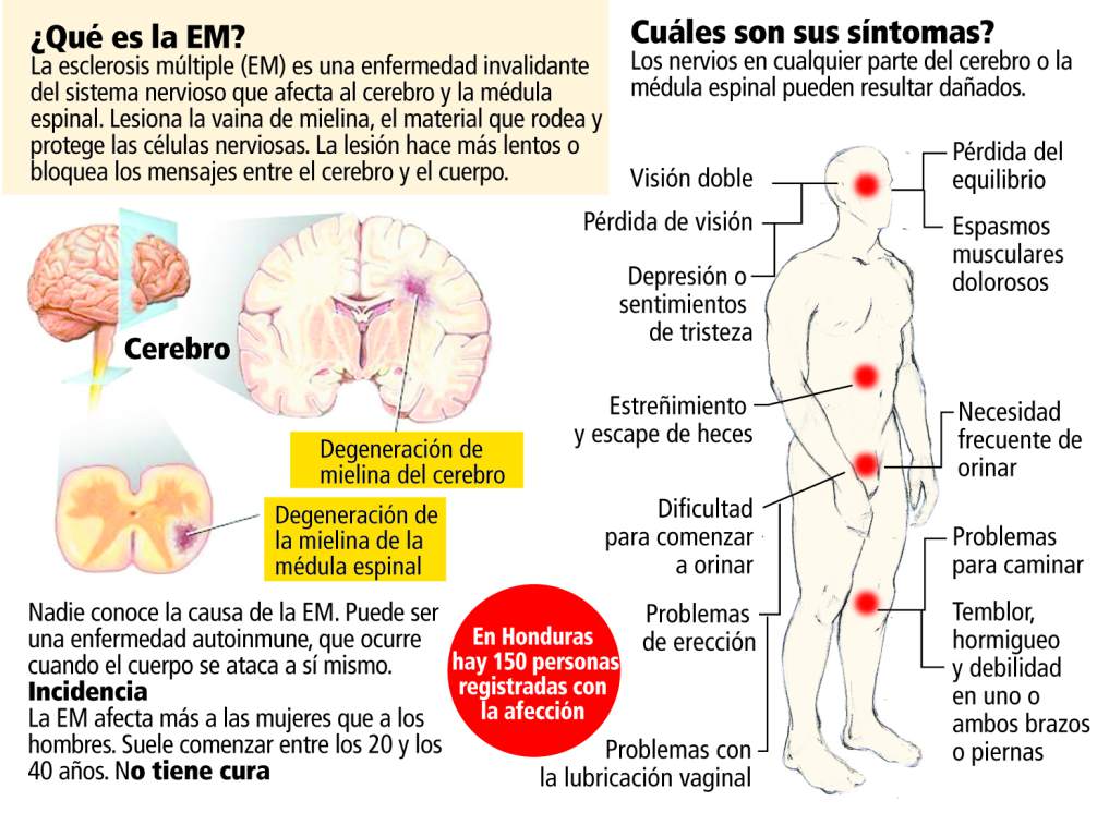 SE DUPLICA LA ESCLEROSIS MULTIPLE EN 20 AÑOS