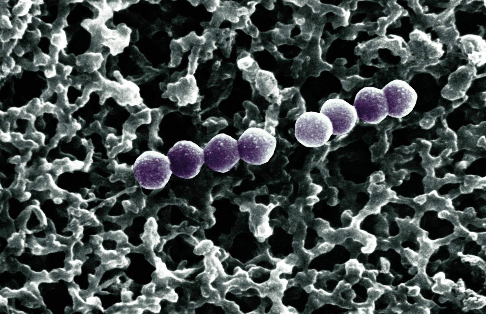 ES LA GUERRA: SUPER-ANTIBIOTICO CONTRA LAS SUPER-BACTERIAS