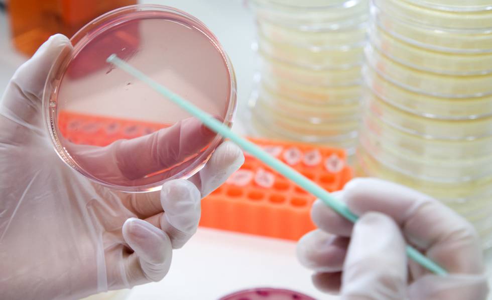 20180905xpress bacterias 3