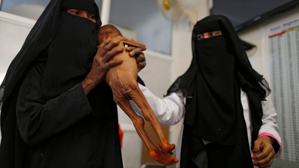 20181031 yemen