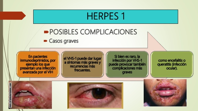 20181102 herpes