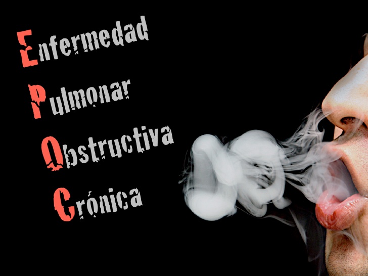 EPOC: MUERTE SILENCIOSA PREVENIBLE