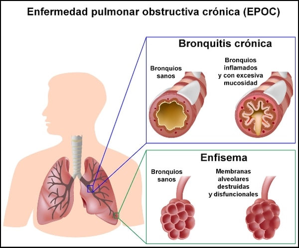 20181127 epoc 3