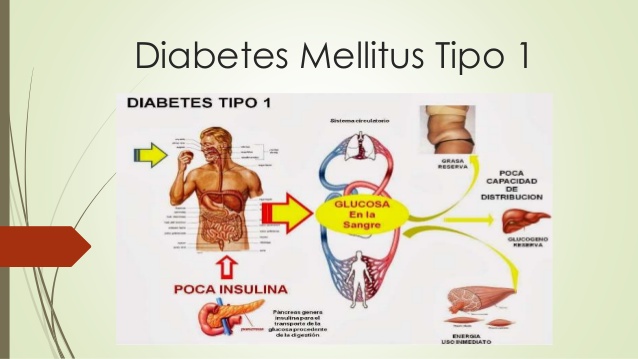 20181206 diabetes mellitus 1