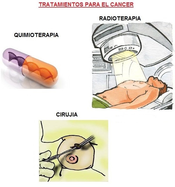 20190201 cancertrata