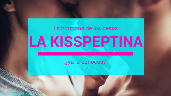 20190209 kiss 3