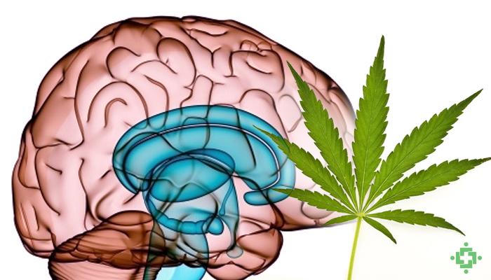 cerebro23