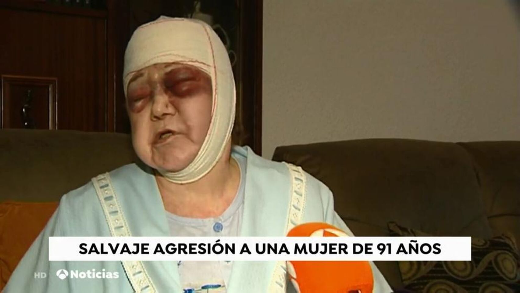 APALEA A UNA MUJER DE 91 AÑOS: ¿CÓMO ES POSIBLE ESTO?