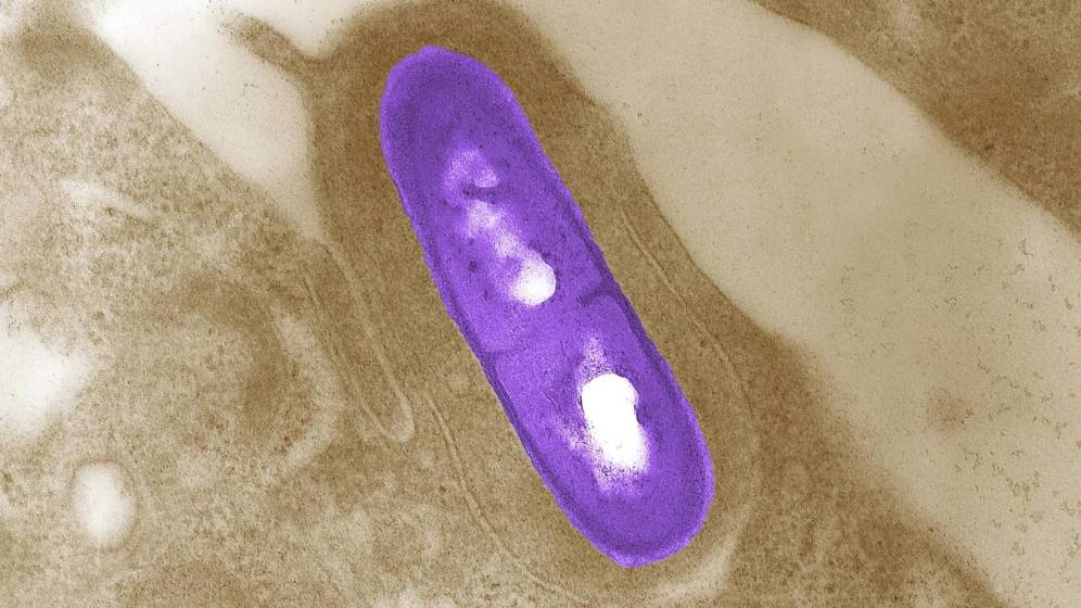 LA LISTERIA, ESE "ENEMIGO" QUE MATA EN LAS COCINAS EUROPEAS