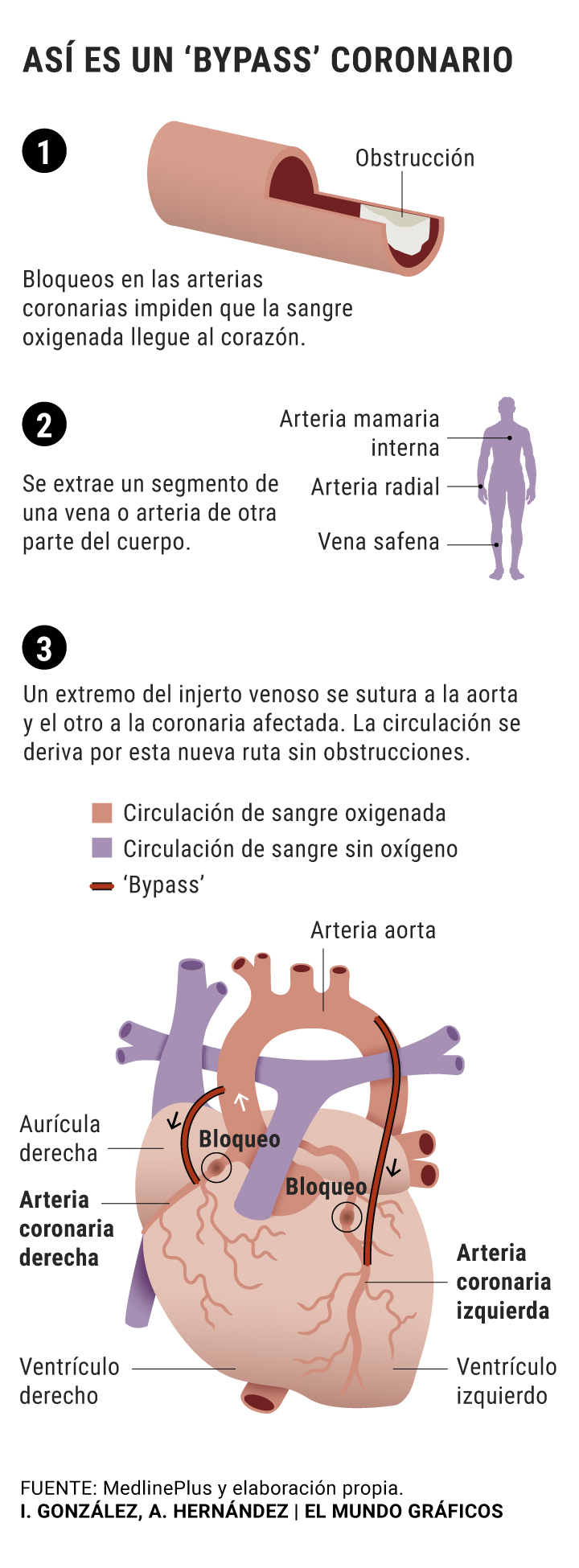 20190827 operacion