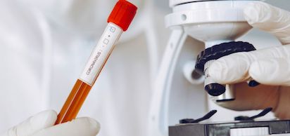 cientifico analizando muestras de sangre 3
