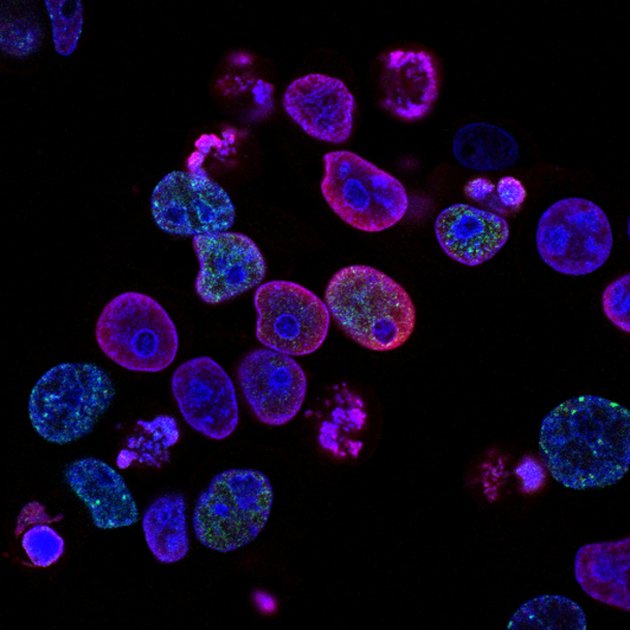 national cancer institute l7en7lb ovc unsplash 1 630x630