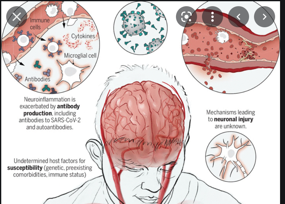 cerebro y covid