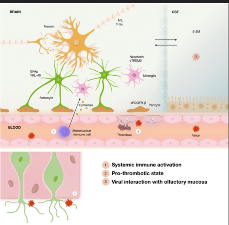 cerebro y covid 2