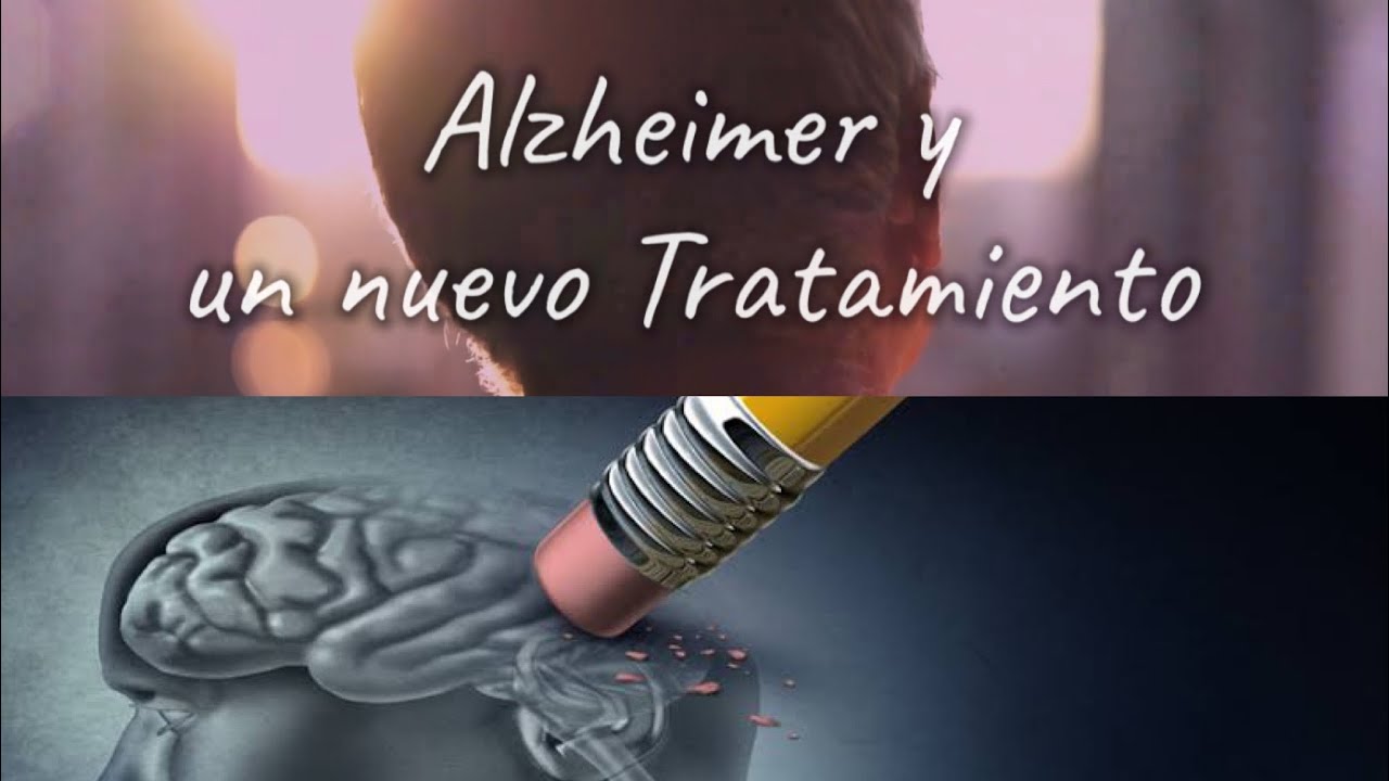 alzheimer 2