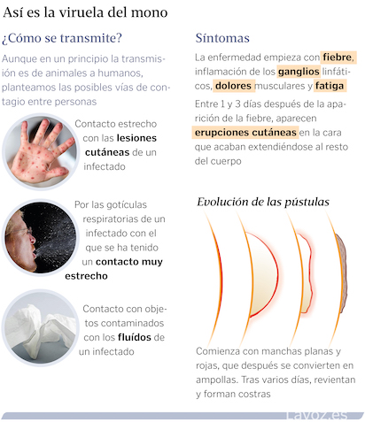 TRANSMISION