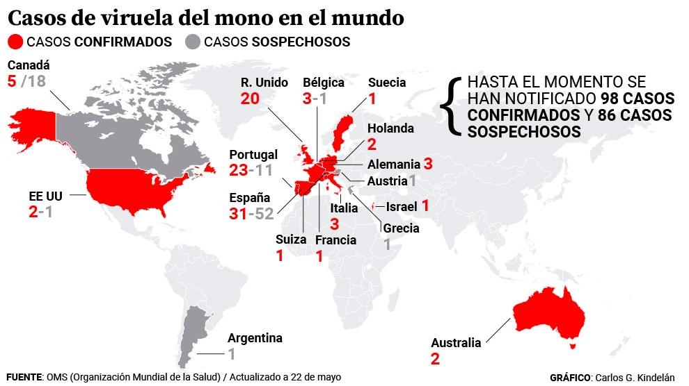viruela del mono