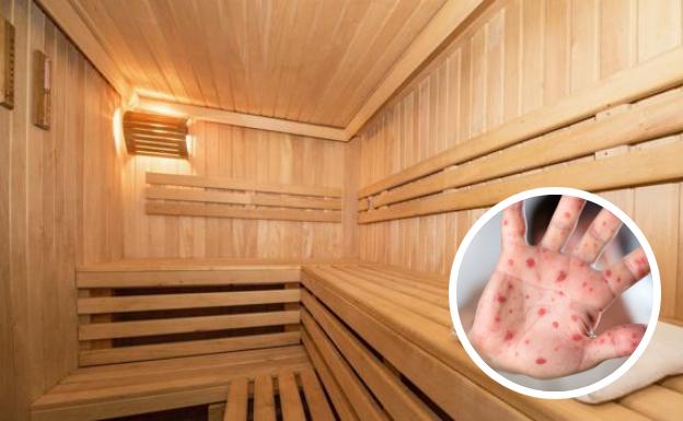 virus mono sauna k9h U17016002295685 624x385El Comercio