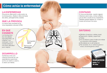 BRONQUIOLITIS COMO ACTUA BEBES