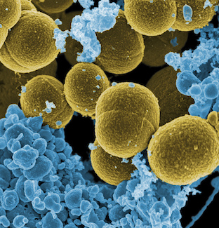 ¿POR QUÉ NO SABEMOS CONVIVIR CON NUESTRAS BACTERIAS?