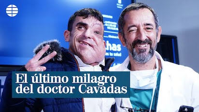 CAVADAS 2