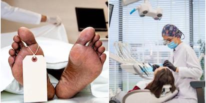 CHINA: ROBAN CADAVERES PARA IMPLANTES DENTALES