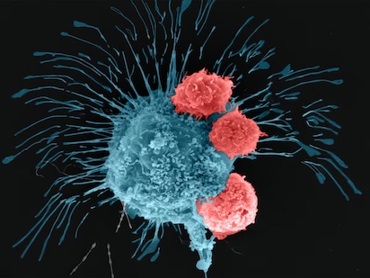 CANCER: DESCUBRIMIENTOS Y MIEDOS