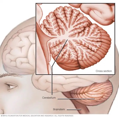 cerebelo 3