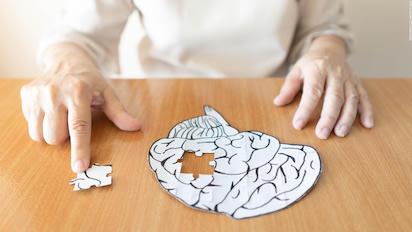 alzheimer 3