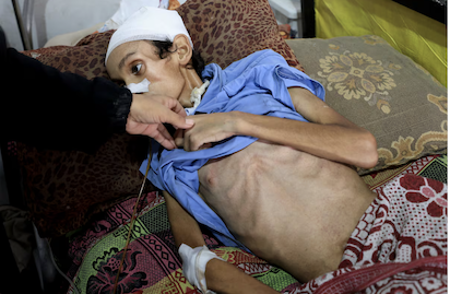 GAZA: MUERTE POR HAMBRE Y POR BUSCAR COMIDA