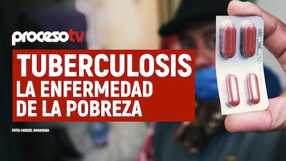 tuberculosis