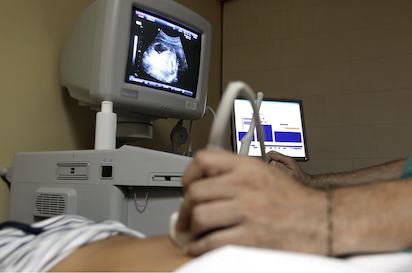 ABORTO EN ESPAÑA… Sí PERO EN LA PRIVADA, PERO PAGADO POR LA PUBLICA