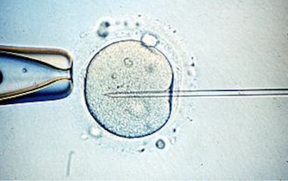 IN VITRO: 197 HIJOS DE UN DONANTE PORTADOR DE UN GEN CANCERÍGENO