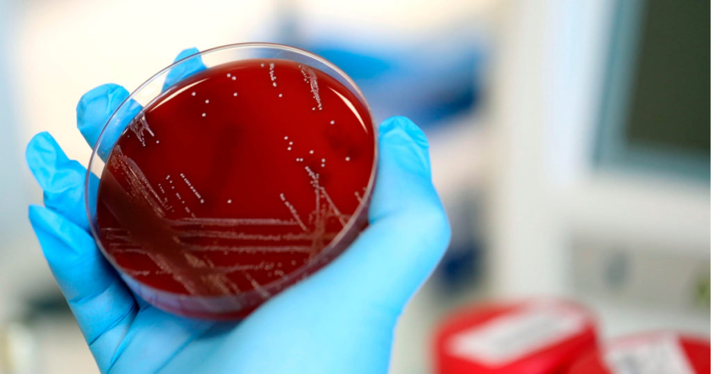 Que es el coronavirus y sintomasEFE 1024x538 1