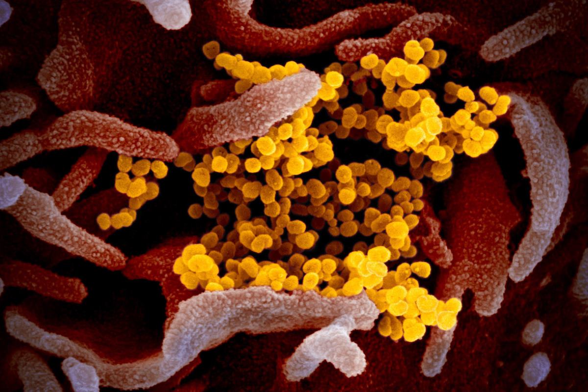 Coronavirus 2 web
